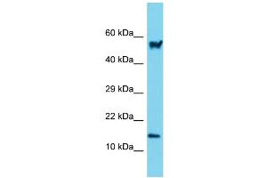 Host: Rabbit Target Name: Arpc5 Sample Type: Mouse Small Intestine lysates Antibody Dilution: 1.