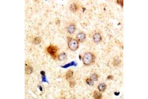 Immunohistochemical analysis of Dematin staining in human brain formalin fixed paraffin embedded tissue section. (Dematin antibody  (C-Term))
