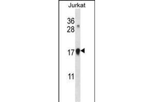 CDKN1A Antibody (C-term) (ABIN657391 and ABIN2846432) western blot analysis in Jurkat cell line lysates (35 μg/lane). (p21 antibody  (C-Term))