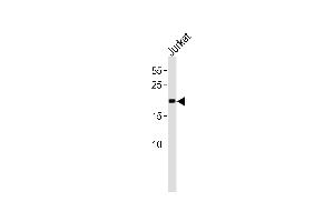 MGMT Antibody (C-term) (ABIN391514 and ABIN2841475) western blot analysis in Jurkat cell line lysates (35 μg/lane). (MGMT antibody  (C-Term))