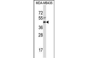 Western blot analysis in MDA-MB435 cell line lysates (35ug/lane). (RPL3 antibody  (AA 224-251))