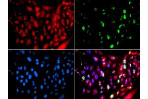 Immunofluorescence analysis of GFP-RNF168 transgenic U2OS cells using UIMC1 antibody.