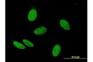 Immunofluorescence of purified MaxPab antibody to WHSC2 on HeLa cell. (WHSC2 antibody  (AA 1-528))