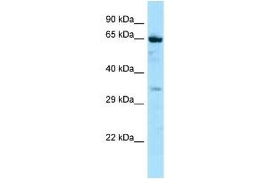 Host: Rabbit Target Name: NOX5 Sample Type: Jurkat Whole Cell lysates Antibody Dilution: 1. (NOX5 antibody  (C-Term))