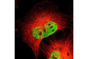 Immunofluorescent staining of U-251 MG with PBX1 polyclonal antibody  (Green) shows positivity in nucleus but excluded from the nucleoli. (PBX1 antibody)