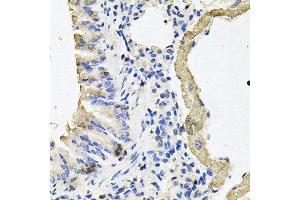 Immunohistochemistry of paraffin-embedded mouse lung using MYH7 antibody at dilution of 1:100 (x40 lens).