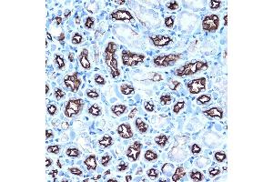 Immunohistochemistry (IHC) image for anti-Mucin 1 (MUC1) (AA 1182-1255) antibody (ABIN6144194)