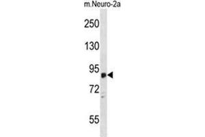 ZDHHC8 Antibody (C-term) western blot analysis in mouse Neuro-2a cell line lysates (35 µg/lane). (ZDHHC8 antibody  (C-Term))