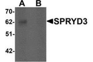 Western blot analysis of SPRYD3 in human brain tissue lysate with SPRYD3 antibody at 1 μg/ml in (A) the absence and (B) the presence of blocking peptide. (SPRYD3 antibody  (Center))