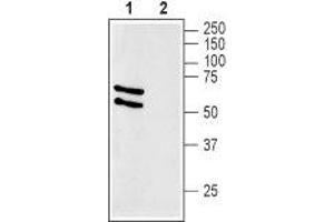 Western blot analysis of rat liver membranes: - 1. (SLC2A2 antibody  (C-Term, Intracellular))