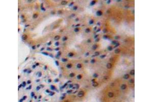 Used in DAB staining on fromalin fixed paraffin-embedded Kidney tissue (VEGFA antibody  (AA 27-146))