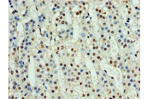 Immunohistochemistry of paraffin-embedded human adrenal gland tissue using ABIN7161152 at dilution of 1:100 (NPHP1 antibody  (AA 1-109))