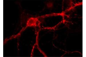 Immunocytochemistry on cultured hippocampus neurons (dilution 1 : 1000). (RAB3A antibody  (AA 154-227))