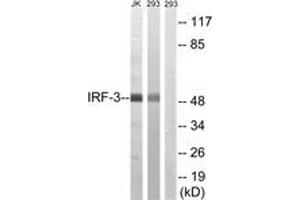 Western blot analysis of extracts from 293/Jurkat cells, using IRF-3 (Ab-386) Antibody. (IRF3 antibody  (AA 352-401))