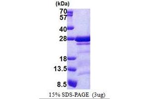 SDS-PAGE (SDS) image for Calcium Modulating Ligand (CAMLG) (AA 1-189) protein (His tag) (ABIN5853110)