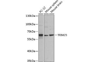 Western blot analysis of extracts of various cell lines, using TRIM23 antibody (ABIN6131175, ABIN6149508, ABIN6149509 and ABIN6224352) at 1:1000 dilution. (TRIM23 antibody  (AA 1-280))