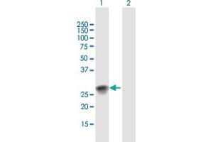 Western Blot analysis of SSX2 expression in transfected 293T cell line by SSX2 MaxPab polyclonal antibody. (SSX2 antibody  (AA 1-188))