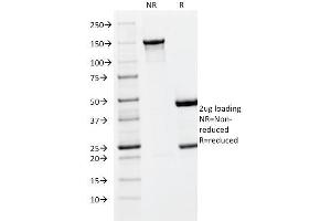 SDS-PAGE Analysis Purified PLGF Monoclonal Antibody (PLGF/93).