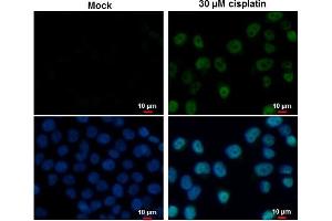 ICC/IF Image p53 antibody [N1], N-term detects p53 protein at nucleus by immunofluorescent analysis. (p53 antibody  (N-Term))