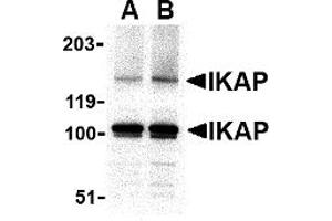 Western Blotting (WB) image for anti-Elongator Complex Protein 1 (ELP1) (C-Term) antibody (ABIN1030431) (IKAP/p150 antibody  (C-Term))