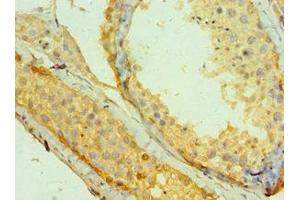Immunohistochemistry of paraffin-embedded human testis tissue using ABIN7159251 at dilution of 1:100 (MAGEA1 antibody  (AA 1-309))