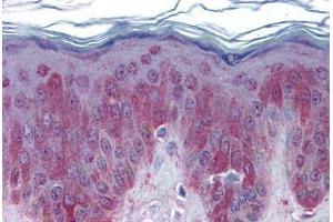 Human Skin: Formalin-Fixed, Paraffin-Embedded (FFPE) (LEFTY1 antibody  (N-Term))