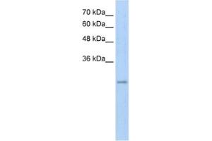 Western Blotting (WB) image for anti-Ret Finger Protein-Like 3 (RFPL3) antibody (ABIN2462662) (RFPL3 antibody)