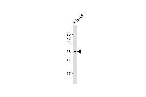 Anti-LDHB Antibody  at 1:2000 dilution + human heart lysate Lysates/proteins at 20 μg per lane.