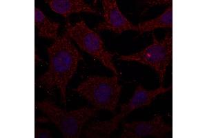 Immunofluorescence - anti-CTSD Ab at 1/100 dilution in NHI/3T3 cells, cells were fixed with methanol and permeabilized With 0. (Cathepsin D antibody  (C-Term))