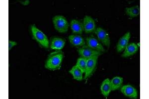 Immunofluorescent analysis of A549 cells using ABIN7142174 at dilution of 1:100 and Alexa Fluor 488-congugated AffiniPure Goat Anti-Rabbit IgG(H+L) (OAS3 antibody  (AA 424-565))