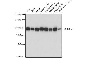 Western blot analysis of extracts of various cell lines, using AFG3L2 antibody (ABIN6292744) at 1:1000 dilution. (AFG3L2 antibody)