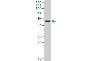 GALT MaxPab polyclonal antibody. (GALT antibody  (AA 1-379))