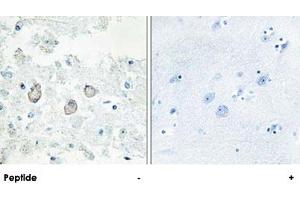 Immunohistochemistry analysis of paraffin-embedded human brain tissue using DOK7 polyclonal antibody . (DOK7 antibody  (N-Term))