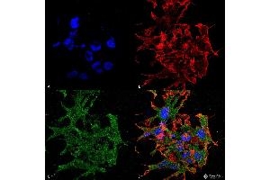 Immunocytochemistry/Immunofluorescence analysis using Mouse Anti-GABA-B Receptor 1 Monoclonal Antibody, Clone S93A-49 . (GABBR1 antibody  (AA 873-977) (FITC))