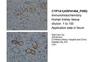 Sample Type: Human KidneyDilution: 1:100 (CYP1A1 antibody  (Middle Region))