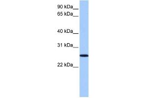 FBXO36 antibody used at 1 ug/ml to detect target protein. (FBXO36 antibody  (N-Term))