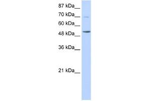 WB Suggested Anti-IKZF3 Antibody Titration:  0. (IKZF3 antibody  (N-Term))