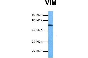 Host:  Rabbit  Target Name:  VIM  Sample Tissue:  Human Fetal Liver  Antibody Dilution:  1.