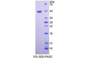 SDS-PAGE analysis of Human CTBS Protein. (CTBS Protein)