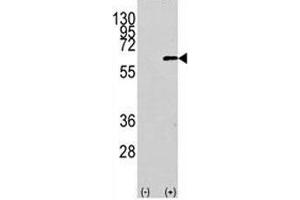 Western blot analysis of AKT1 antibody and 293 cell lysate (2 ug/lane) either nontransfected (Lane 1) or transiently transfected with the human gene (2). (AKT1 antibody  (AA 115-144))