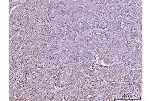 IHC analysis of HLA-DRA using anti-HLA-DRA antibody (ABIN7600949). (HLA-DRA antibody  (AA 26-254))