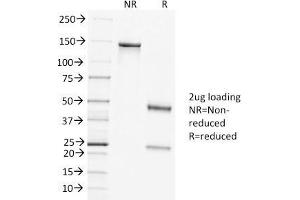 SDS-PAGE Analysis of Purified Clathrin HC Mouse Monoclonal Antibody (CLTC/1431).