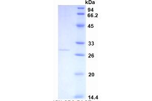 SDS-PAGE of Protein Standard from the Kit (Highly purified E. (CRP ELISA Kit)