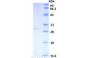 SDS-PAGE (SDS) image for C-Reactive Protein (CRP) ELISA Kit (ABIN6574108)