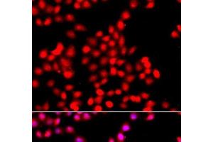 Immunofluorescence analysis of A549 cells using TTBK2 Polyclonal Antibody (TTBK2 antibody)