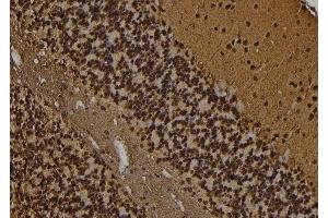 ABIN6269402 at 1/100 staining Rat brain tissue by IHC-P.