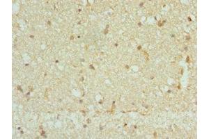 Immunohistochemistry of paraffin-embedded human brain tissue using ABIN7146447 at dilution of 1:100 (CAMK2B antibody  (AA 1-300))