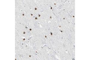 Immunohistochemical staining (Formalin-fixed paraffin-embedded sections) of human cerebral cortex with ZIC1 polyclonal antibody  shows strong nuclear positivity in neuronal and glial cells. (ZIC1 antibody)