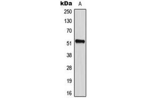 Western blot analysis of CD2BP2 expression in HeLa (A) whole cell lysates. (CD2BP2 antibody  (Center))
