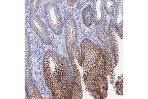 Immunohistochemical staining of human stomach, upper with DHX34 polyclonal antibody  shows strong cytoplasmic and membranous positivity in glandular cells. (DHX34 antibody)